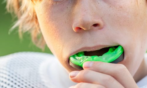 Best Lacrosse Mouthguard