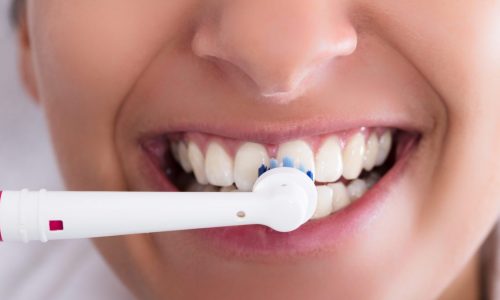 Woman brushes teeth with electric toothbrush