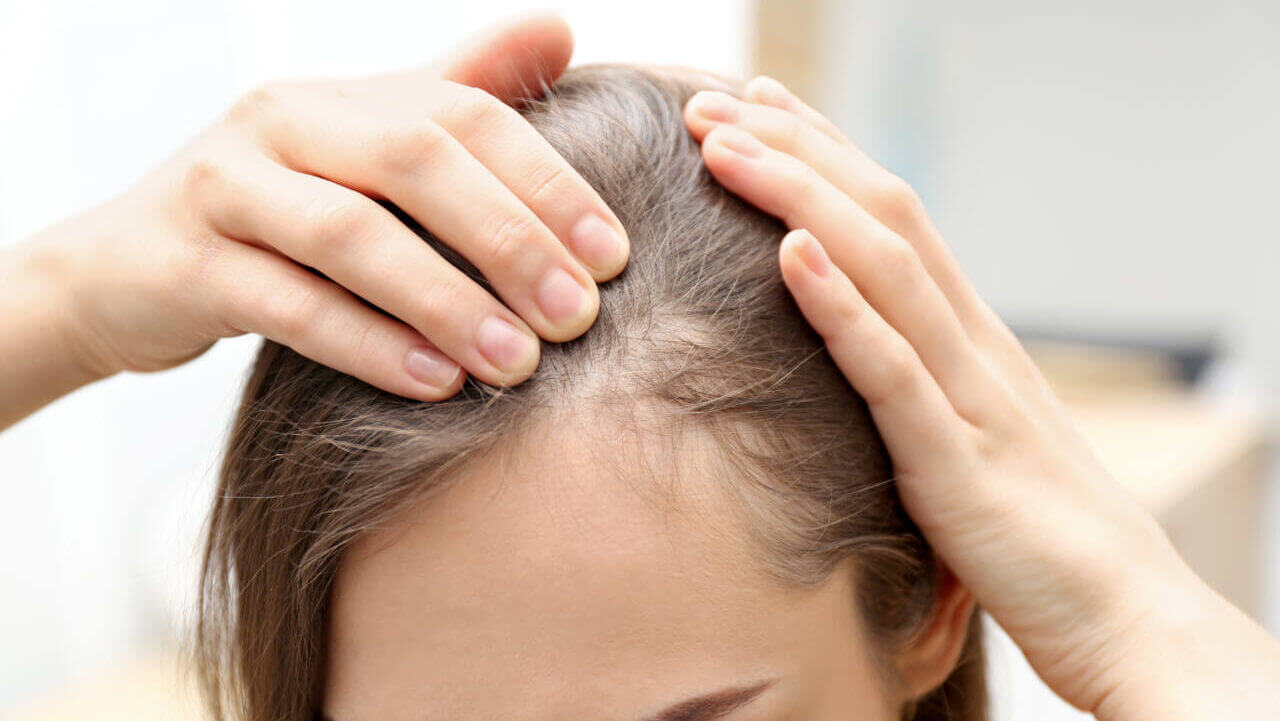 Young woman with hair loss problem indoors, closeup